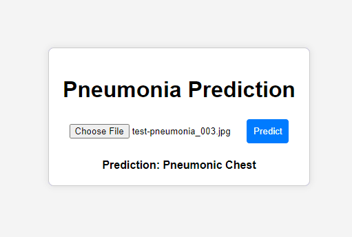 Predicting Pneumonia from Chest X-rays using Deep Learning, Computer Vision, and Flask